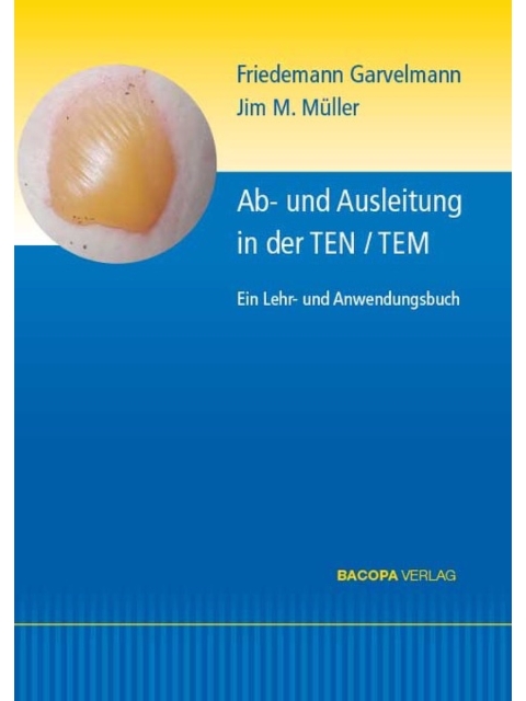 Ab- und Ausleitung in der TEN / TEM