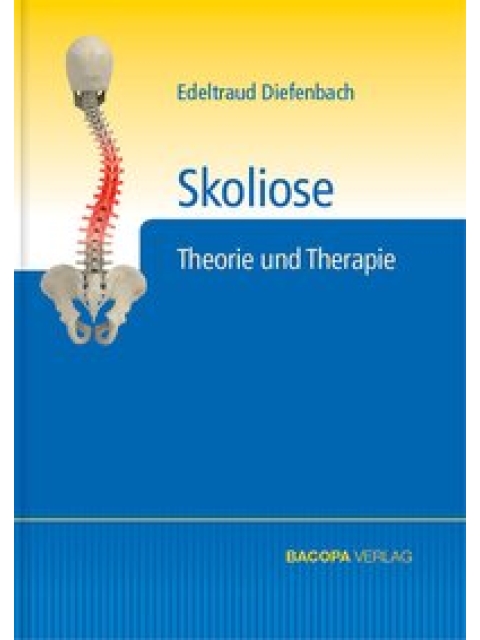 Skoliose
