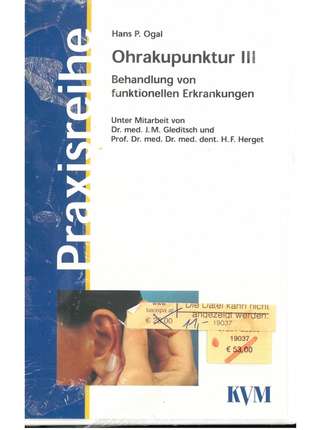 Video Ohrakupunktur III